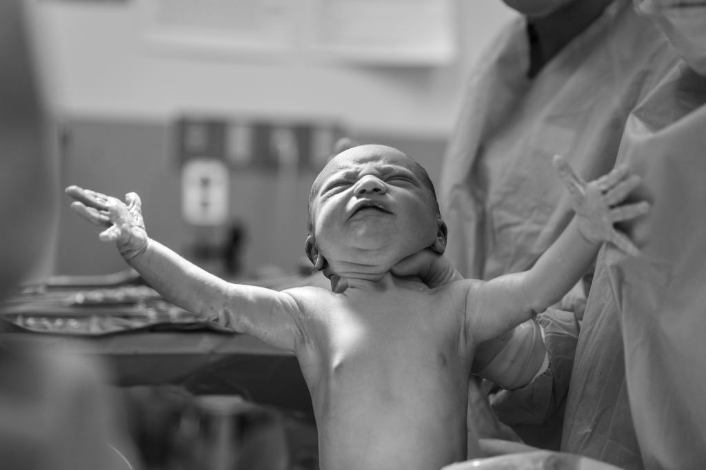 A black and white image of a newborn baby, arms and fingers outstretched.
